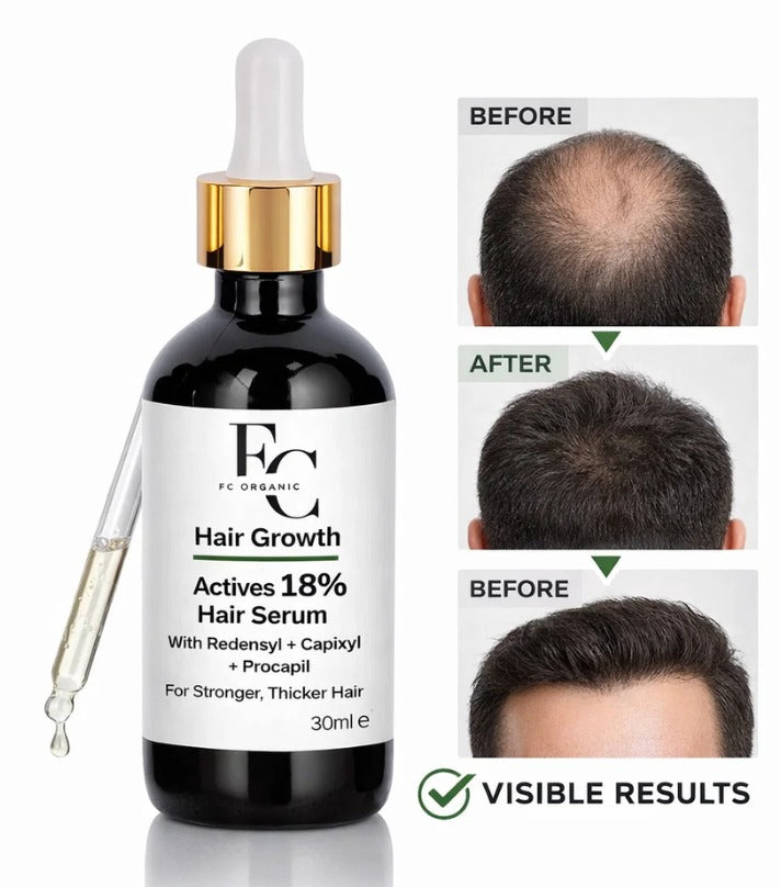 Proskire Intense Hair Growth Serum